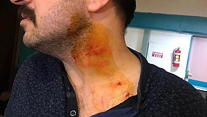 HASTA YAKINI GÖREVLİYİ ISIRDI