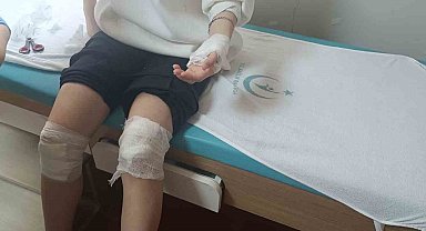 Elazığ'da 17 Yaşındaki Kız Sokak Köpeklerinin Saldırısına Uğradı